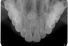 Imagem Categoria Radiografia Oclusal