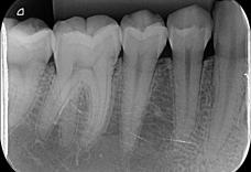 Imagem Categoria Radiografia Periapical